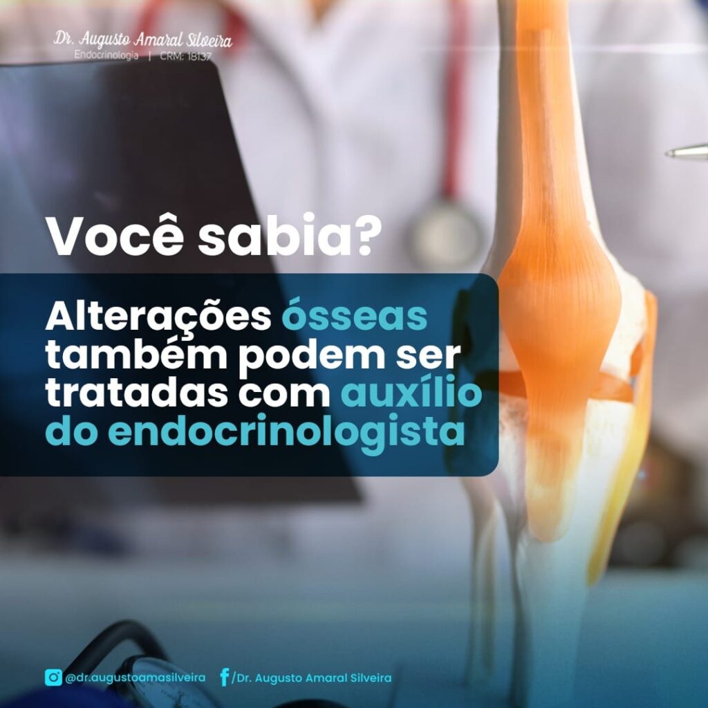 Alterações Ósseas: veja o que é importante saber sobre Osteoporose